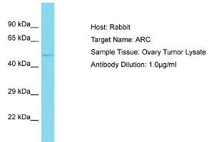 Host: Rabbit Target Name: ARC Sample Type: Ovary Tumor lysates Antibody Dilution: 1. (ARC (C-Term) antibody)
