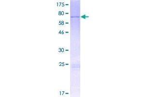 Image no. 1 for Methyltransferase Like 17 (METTL17) (AA 1-456) protein (GST tag) (ABIN1310752)