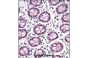 TERF2 Antibody (Center) ((ABIN657781 and ABIN2846755))immunohistochemistry analysis in formalin fixed and paraffin embedded human colon tissue followed by peroxidase conjugation of the secondary antibody and DAB staining. (TRF2 antibody  (AA 308-337))