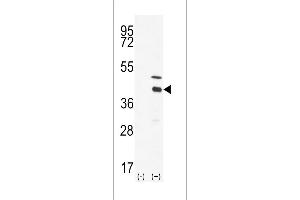 Western blot analysis of DOK4 using DOK4 Antibody using 293 cell lysates (2 ug/lane) either nontransfected (Lane 1) or transiently transfected with the DOK4 gene (Lane 2).
