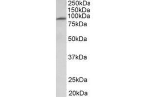 AP31934PU-N MFSD6 antibody staining of Human Heart lysate at 1 µg/ml (35µg protein in RIPA buffer). (MFSD6 antibody  (Extracellular Domain))