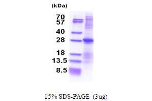 SDS-PAGE (SDS) image for ATPase, Na+/K+ Transporting, beta 3 Polypeptide (ATP1B3) (AA 57-279) protein (His tag) (ABIN5853699)