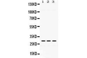Western blot analysis of ADO expression in rat testis extract ( Lane 1), mouse kidney extract ( Lane 2) and HELA whole cell lysates ( Lane 3). (ADO antibody  (AA 49-261))
