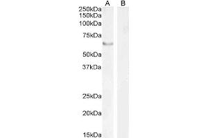 Western Blotting (WB) image for anti-Forkhead Box C2 (MFH-1, Mesenchyme Forkhead 1) (FOXC2) (C-Term) antibody (ABIN185029)