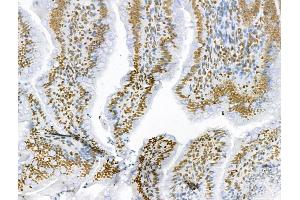 ABIN6259813 and ABIN6273089 at 1/100 staining Rat colon tissue by IHC-P.