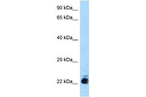 WB Suggested Anti-Slc31a1 Antibody Titration: 1. (SLC31A1 antibody  (N-Term))