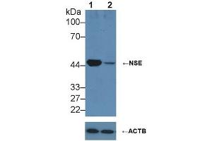 Knockout Varification: ;Lane 1: Wild-type HepG2 cell lysate; ;Lane 2: NSE knockout HepG2 cell lysate; ;Predicted MW: 43,48kDa ;Observed MW: 50kDa;Primary Ab: 2µg/ml Rabbit Anti-Human NSE Antibody;Second Ab: 0. (ENO2/NSE antibody  (AA 1-434))