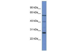 Western Blot showing CYP24A1 antibody used at a concentration of 1-2 ug/ml to detect its target protein. (CYP24A1 antibody  (C-Term))