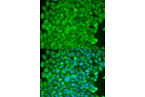 Immunofluorescence analysis of HeLa cells using SGCE antibody. (SGCE antibody)
