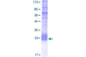 Image no. 1 for CD70 Molecule (CD70) (AA 52-193) protein (His-DYKDDDDK-Strep II Tag) (ABIN4369859)
