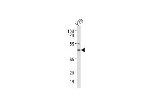 RDH10 Antibody (Center) (ABIN650935 and ABIN2840001) western blot analysis in Y79 cell line lysates (35 μg/lane). (RDH10 antibody  (AA 106-135))