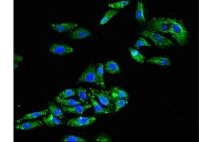 Immunofluorescent analysis of HepG2 cells using ABIN7153601 at dilution of 1:100 and Alexa Fluor 488-congugated AffiniPure Goat Anti-Rabbit IgG(H+L) (GJA8 antibody  (AA 286-432))