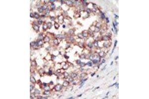 Image no. 1 for anti-Phosphoinositide-3-Kinase, Catalytic, gamma Polypeptide (PIK3CG) (AA 1073-1102), (C-Term) antibody (ABIN360452) (PIK3 gamma antibody  (C-Term))