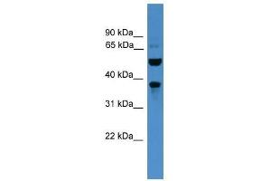 Western Blot showing BEST3 antibody used at a concentration of 1-2 ug/ml to detect its target protein. (Bestrophin 3 antibody  (C-Term))