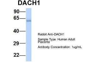 Host:  Rabbit  Target Name:  DACH1  Sample Type:  Human Adult Placenta  Antibody Dilution:  1. (DACH1 antibody  (N-Term))