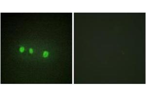 Immunofluorescence analysis of HepG2 cells, using ZIC1/2/3/4/5 Antibody. (ZIC1/2/3 antibody  (AA 281-330))