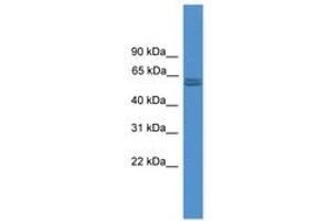 Image no. 1 for anti-Pyruvate Kinase, Muscle (PKM) (N-Term) antibody (ABIN6745472) (Pyruvate Kinase, Muscle (PKM) (N-Term) antibody)