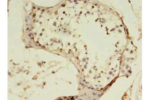 Immunohistochemistry of paraffin-embedded human testis tissue using ABIN7170663 at dilution of 1:100 (SART3 antibody  (AA 600-900))