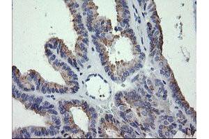 Image no. 3 for anti-Cancer/testis Antigen 1B (CTAG1B) antibody (ABIN1499898) (CTAG1B antibody)