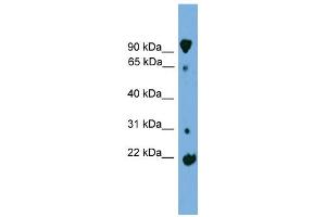 WB Suggested Anti-KLHL2 Antibody Titration: 0. (KLHL2 antibody  (Middle Region))