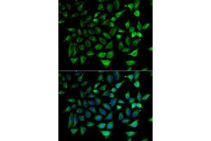 Immunofluorescence analysis of HeLa cell using SLC25A20 antibody. (SLC25A20 antibody)