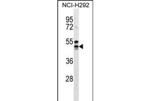 NIACR1 Antibody (Center) (ABIN656596 and ABIN2845857) western blot analysis in NCI- cell line lysates (35 μg/lane).