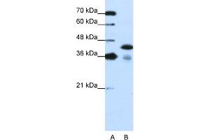 WB Suggested Anti-TARDBP Antibody Titration:  1. (TARDBP antibody  (C-Term))