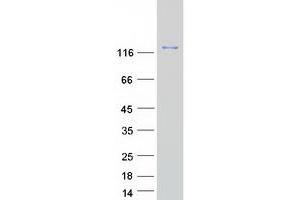 Western Blotting (WB) image for Nitric Oxide Synthase 3 (Endothelial Cell) (NOS3) protein (Myc-DYKDDDDK Tag) (ABIN2727473)