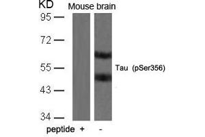 Western blot analysis of extracts from mouse brain tissue using Tau(Phospho-Ser356) Antibody and the same antibody preincubated with blocking peptide. (MAPT antibody  (pSer356))