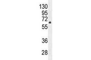 HNF1B antibody western blot analysis in MDA-MB231 lysate. (HNF1B antibody  (AA 498-529))
