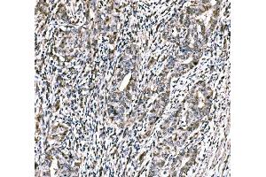 IHC analysis of CBX2 using anti-CBX2 antibody (ABIN7599466). (CBX2 antibody  (AA 1-532))