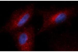 Immunofluorescence (IF) image for anti-Complement Factor Bb antibody (PE) (ABIN5564992) (Complement Factor Bb antibody  (PE))