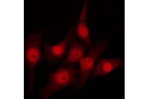 ABIN6273516 staining HuvEc by IF/ICC. (MSH3 antibody  (N-Term))