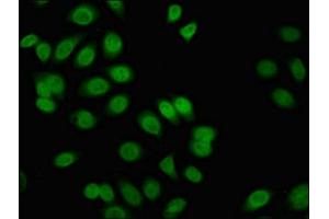 Immunofluorescence (IF) image for anti-Friend Leukemia Virus Integration 1 (FLI1) (AA 205-331) antibody (ABIN7153171)