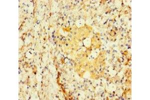 Immunohistochemistry of paraffin-embedded human pancreatic tissue using ABIN7171622 at dilution of 1:100 (TBC1D24 antibody  (AA 1-169))