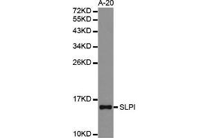 Western blot analysis of extracts of A-20 cell lines, using SLPI antibody. (SLPI antibody  (AA 26-132))