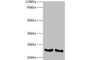 Western blot All lanes: IFNA14 antibody at 2 μg/mL Lane 1: A549 whole cell lysate Lane 2: Mouse heart tissue Secondary Goat polyclonal to rabbit IgG at 1/10000 dilution Predicted band size: 23 kDa Observed band size: 23 kDa (IFNa14 antibody  (AA 24-189))