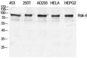 Western Blotting (WB) image for anti-Ribosomal Protein S6 Kinase, 90kDa, Polypeptide 6 (RPS6KA6) (C-Term) antibody (ABIN3177309) (RPS6KA6 antibody  (C-Term))