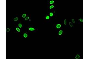 Immunofluorescent analysis of Hela cells treated by NaB using ABIN7139153 at dilution of 1:100 and Alexa Fluor 488-congugated AffiniPure Goat Anti-Rabbit IgG(H+L) (HIST1H4A antibody  (acLys12))