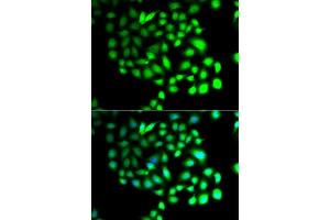 Immunofluorescence analysis of A549 cells using TCEAL8 antibody (ABIN5974946). (TCEAL8 antibody)