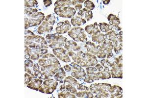 Immunohistochemistry of paraffin-embedded mouse pancreas using RPS15A Rabbit pAb (ABIN6131092, ABIN6147201, ABIN6147202 and ABIN6214414) at dilution of 1:200 (40x lens). (RPS15A antibody  (AA 1-130))