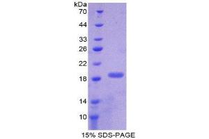 SDS-PAGE (SDS) image for Pleiotrophin (PTN) (AA 33-168) protein (His tag) (ABIN1980919)
