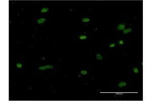 Immunofluorescence of monoclonal antibody to CRY1 on HeLa cell.