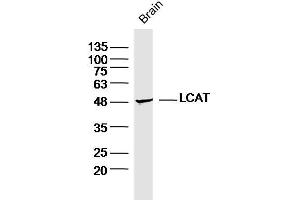 Mouse brain lysates probed with LCAT Polyclonal Antibody, Unconjugated  at 1:300 dilution and 4˚C overnight incubation. (LCAT antibody  (AA 151-250))