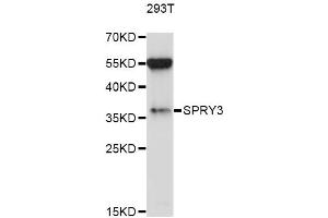 Western blot analysis of extracts of 293T cells, using SPRY3 antibody (ABIN6293588) at 1:1000 dilution. (SPRY3 antibody)