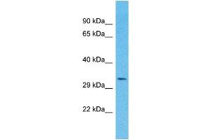 Western Blotting (WB) image for anti-Olfactory Receptor, Family 4, Subfamily A, Member 16 (OR4A16) (C-Term) antibody (ABIN2791731) (OR4A16 antibody  (C-Term))