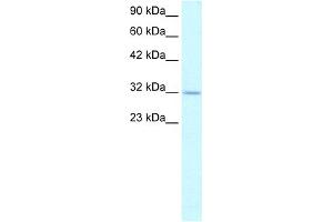 WB Suggested Anti-APEX1 Antibody Titration:  1. (APEX1 antibody  (N-Term))