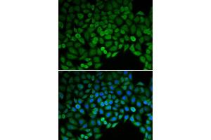 Immunofluorescence (IF) image for anti-Catenin (Cadherin-Associated Protein), delta 1 (CTNND1) (AA 573-832) antibody (ABIN6218725) (CTNND1 antibody  (AA 573-832))