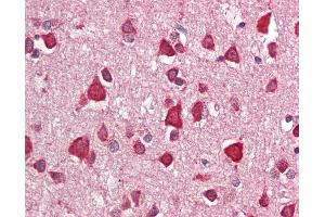 Anti-CRIM1 antibody IHC staining of human brain, cortex. (CRIM1 antibody  (C-Term))