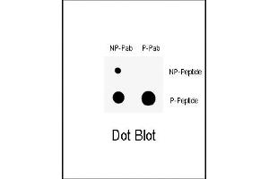 Dot blot analysis of anti-Phospho-Wee1- Antibody (ABIN389681 and ABIN2839651) on nitrocellulose membrane. (WEE1 antibody  (pSer123))